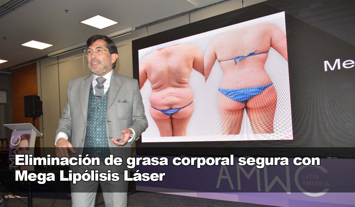 Eliminación de grasa corporal segura y efectiva con el Mega Lipólisis Láser