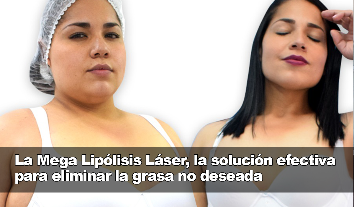 La Mega Lipólisis Láser, mejor alternativa para diluir la grasa sin riesgos
