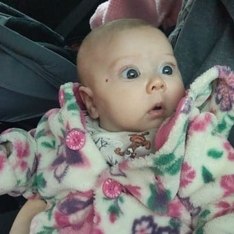"Mi beba nació con hermosos ojos azules, pero descubrimos algo terrible"