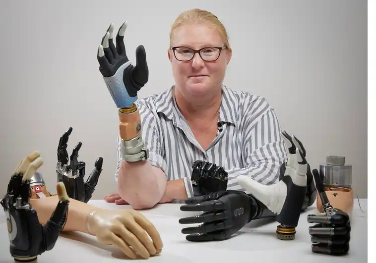 Karin con su mano biónica