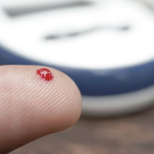 La solución para el monitoreo de glucosa: Prodigy AutoCode